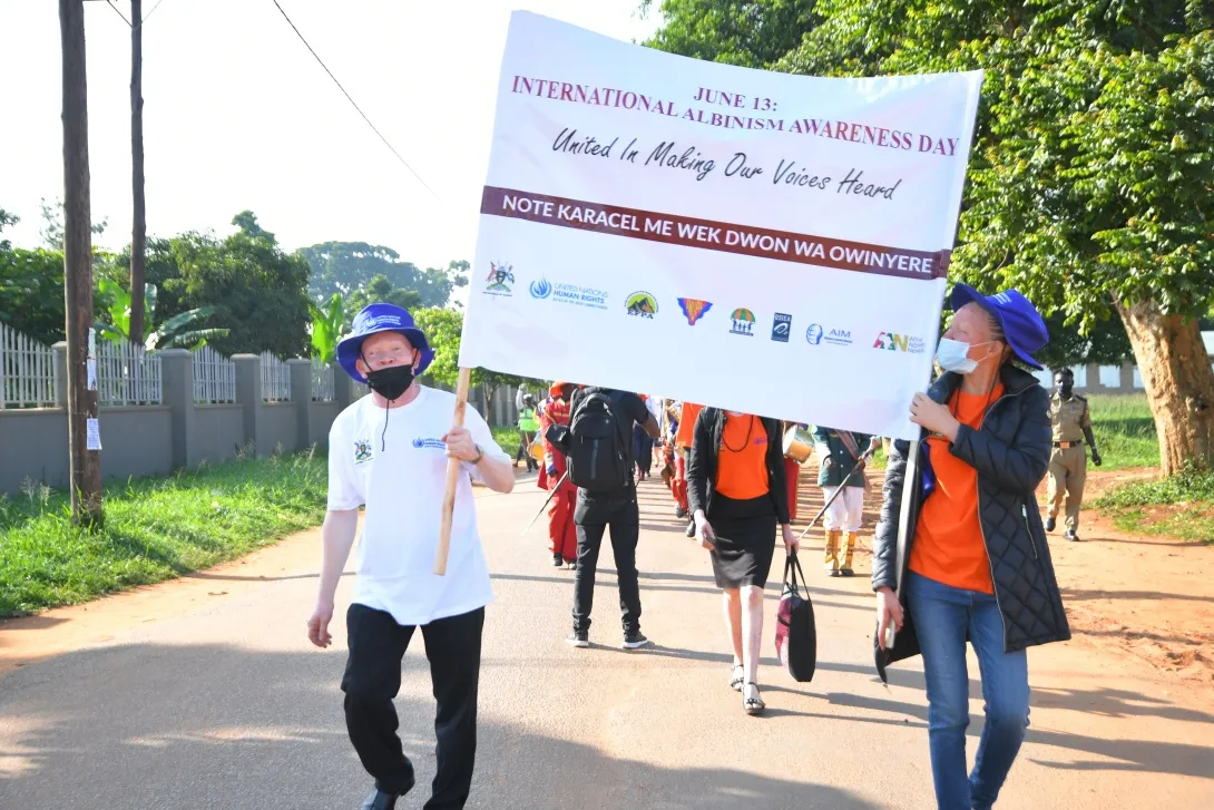 Remarks By Mr. Robert Kotchani, The Country Representative United Nations Office Of The High Commissioner For Human Rights (OHCHR) In Uganda International Albinism Awareness Day Commemoration & Launch Of The National Action Plan For Persons With Albinism In Uganda