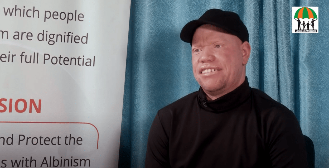 Life With Albinism – Okwi Simon Peter