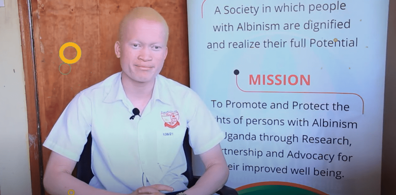 Life With Albinism – Succeeding in School