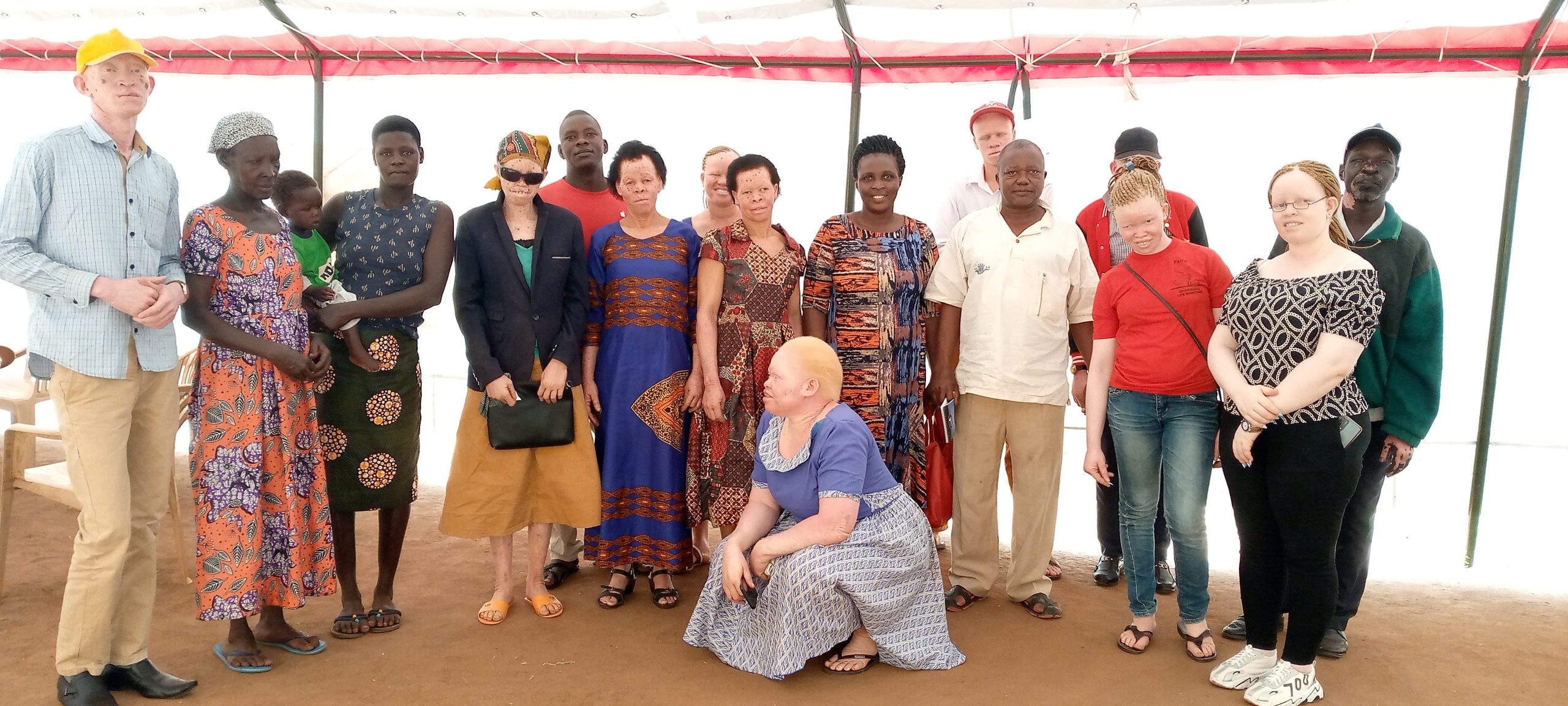 The Unknown about Albinism – a VOICE funded project