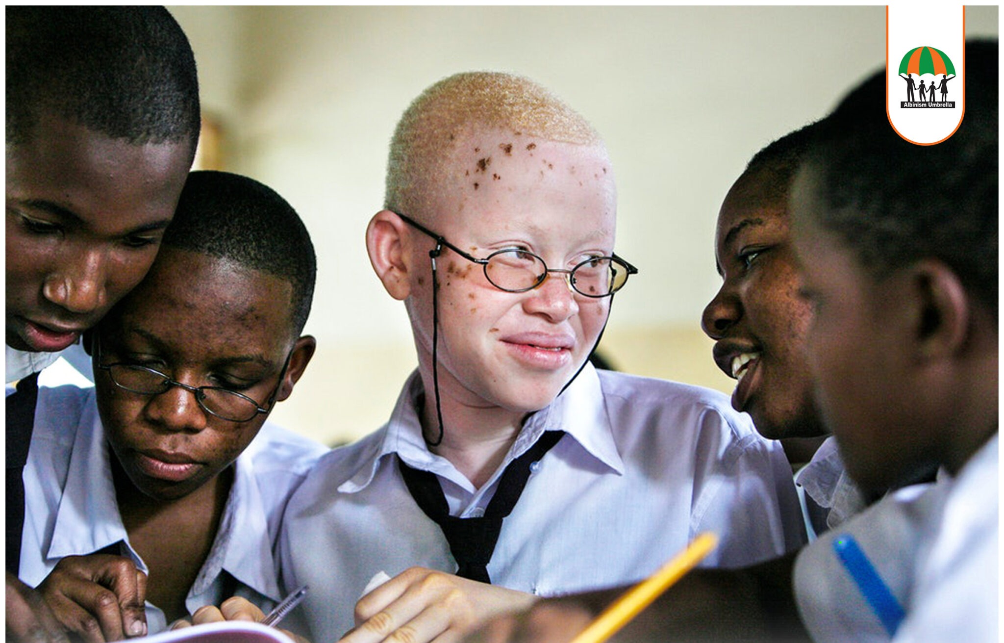 Albinism Umbrella At Five Years Of Existence