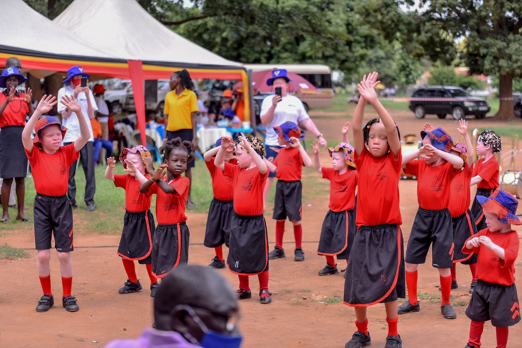 Capacity Development With Albinism Umbrella – Change Story