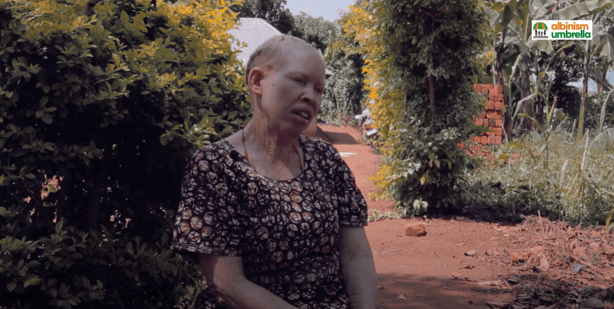 Living White Documentary Series – Episode Two featuring Agnes
