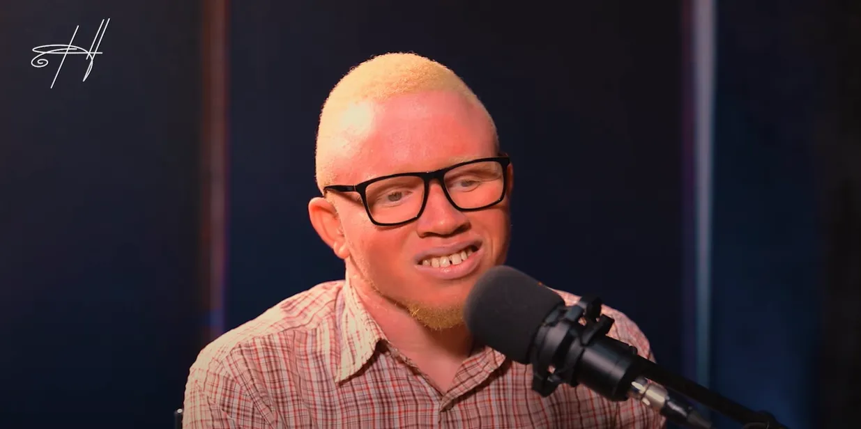 Facts & Misconceptions About Albinism In Uganda – Paul’s Life Story